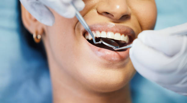 Best Emergency Wisdom Tooth Extraction in Eagle Grove, IA