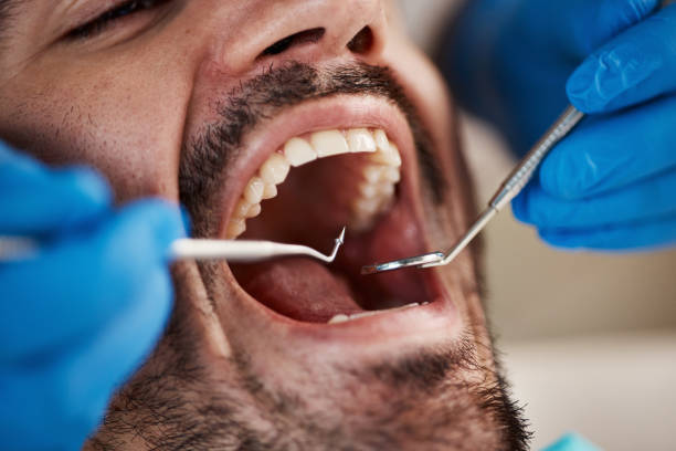 Best Broken or Chipped Tooth Repair in Eagle Grove, IA
