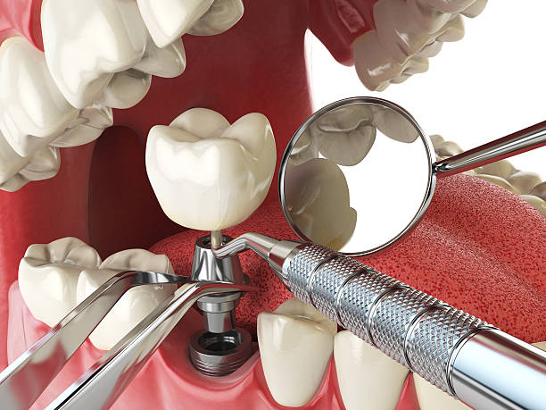 Best Emergency Treatment for Jaw Pain or Injury in Eagle Grove, IA
